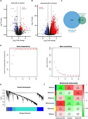 Multi-Omics Analysis of Diabetic Nephropathy Reveals Potential New Mechanisms and Drug Targets